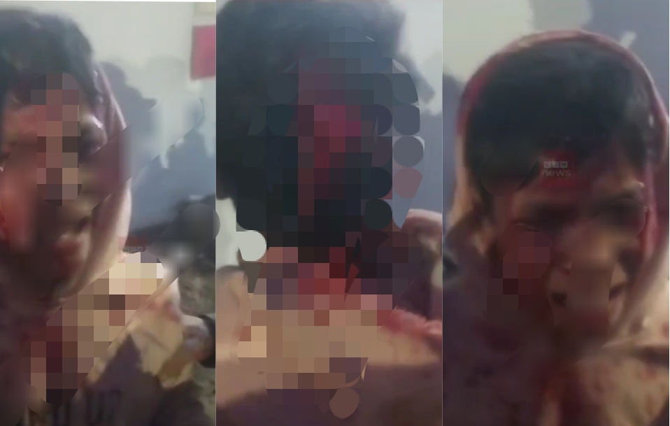 Uttarakhand: Now Guldar attack here_Child admitted to hospital in critical condition, people in panic