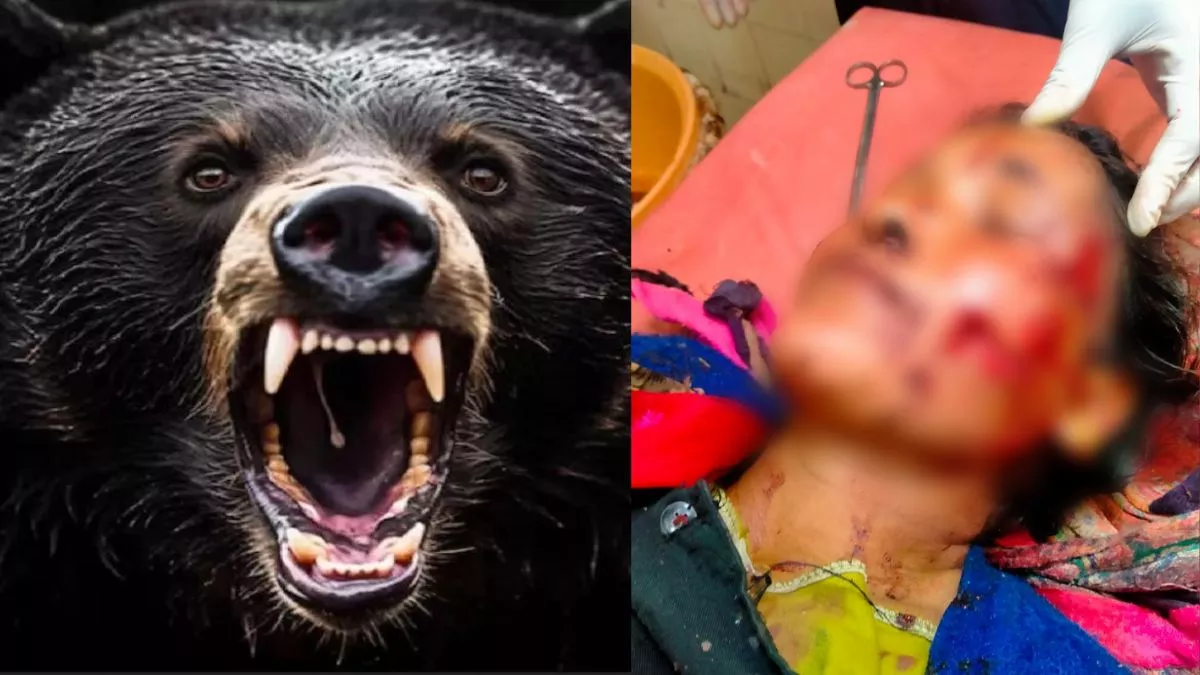 Uttarakhand: A bear suddenly attacked a woman here. Her face was badly injured.