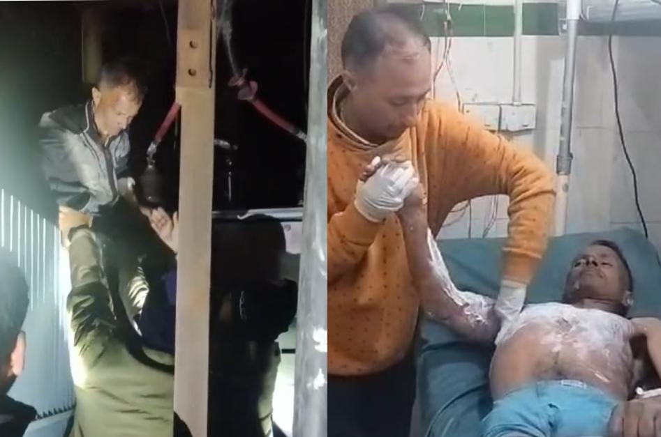 नैनीताल : ट्रांसफार्मर की चपेट में आने से कर्मचारी झुलसा, निगरानी में..हालत गंभीर।